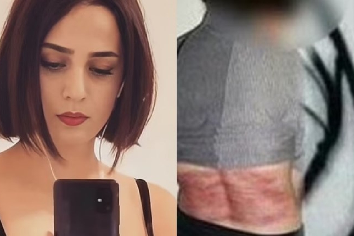 Ιράν | 33χρονη γυναίκα μαστιγώθηκε 74 φορές επειδή δεν φορούσε μαντίλα