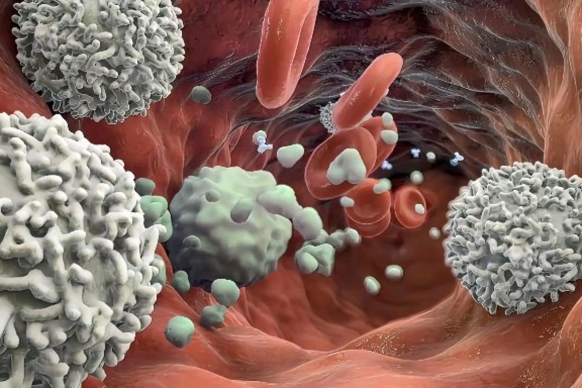 Οι καρκινικοί όγκοι μπορεί να περιέχουν πολλά είδη μυκήτων, σύμφωνα με νέα μελέτη