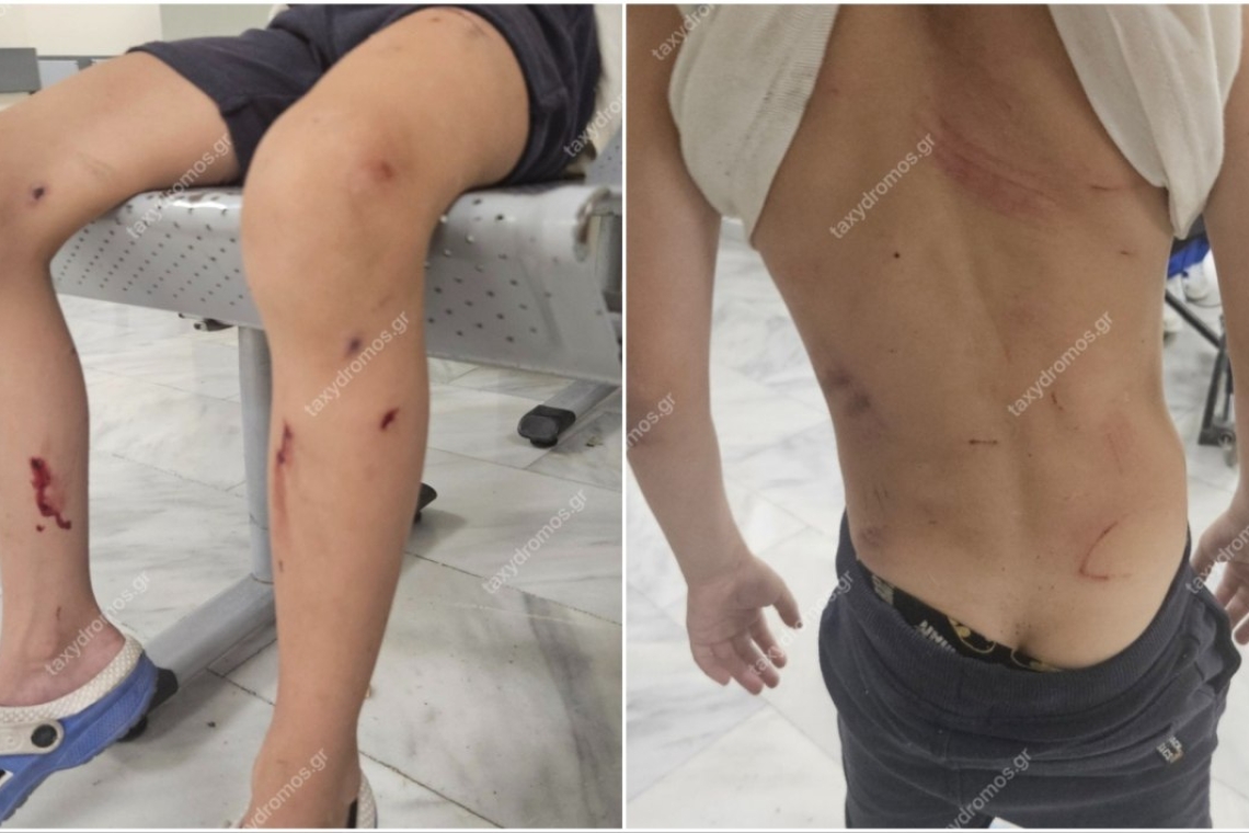 Αδέσποτα σκυλιά επιτέθηκαν σε 7χρονο στο Βόλο