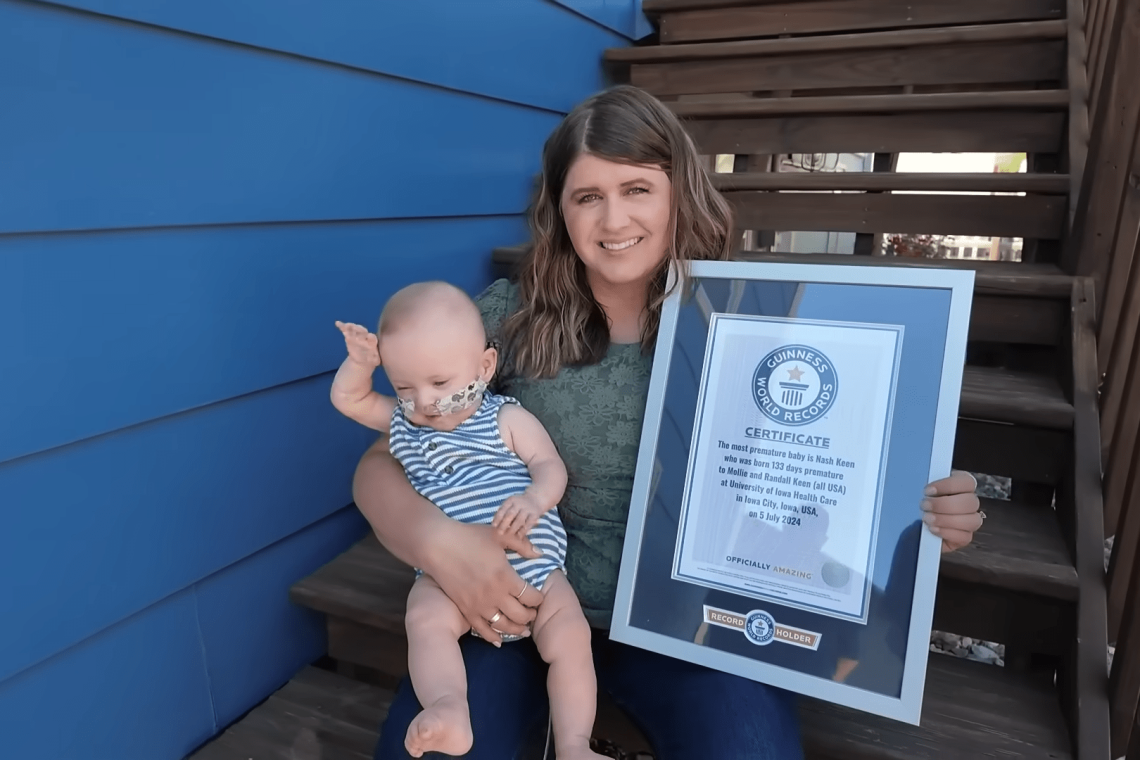 Το πιο πρόωρο μωρό στον κόσμο γιορτάζει τα πρώτα του γενέθλια