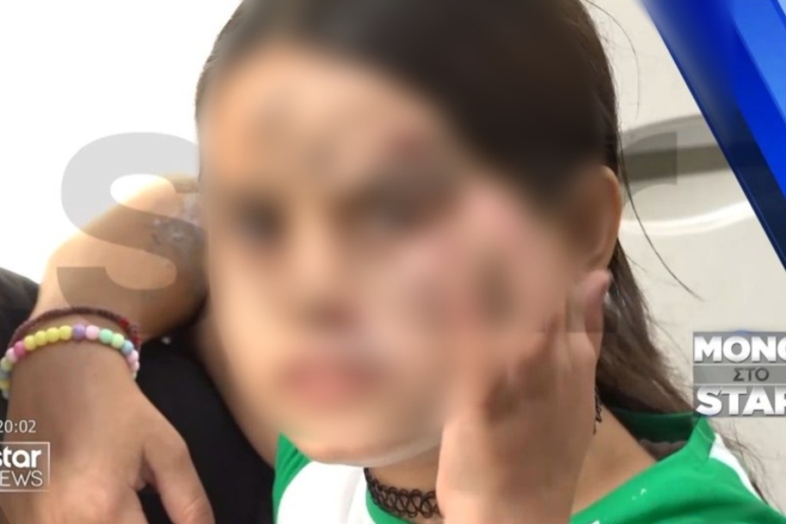 Γονείς προσοχή! Αποτυχημένη απόπειρα απαγωγής 9χρονης στα Σεπόλια